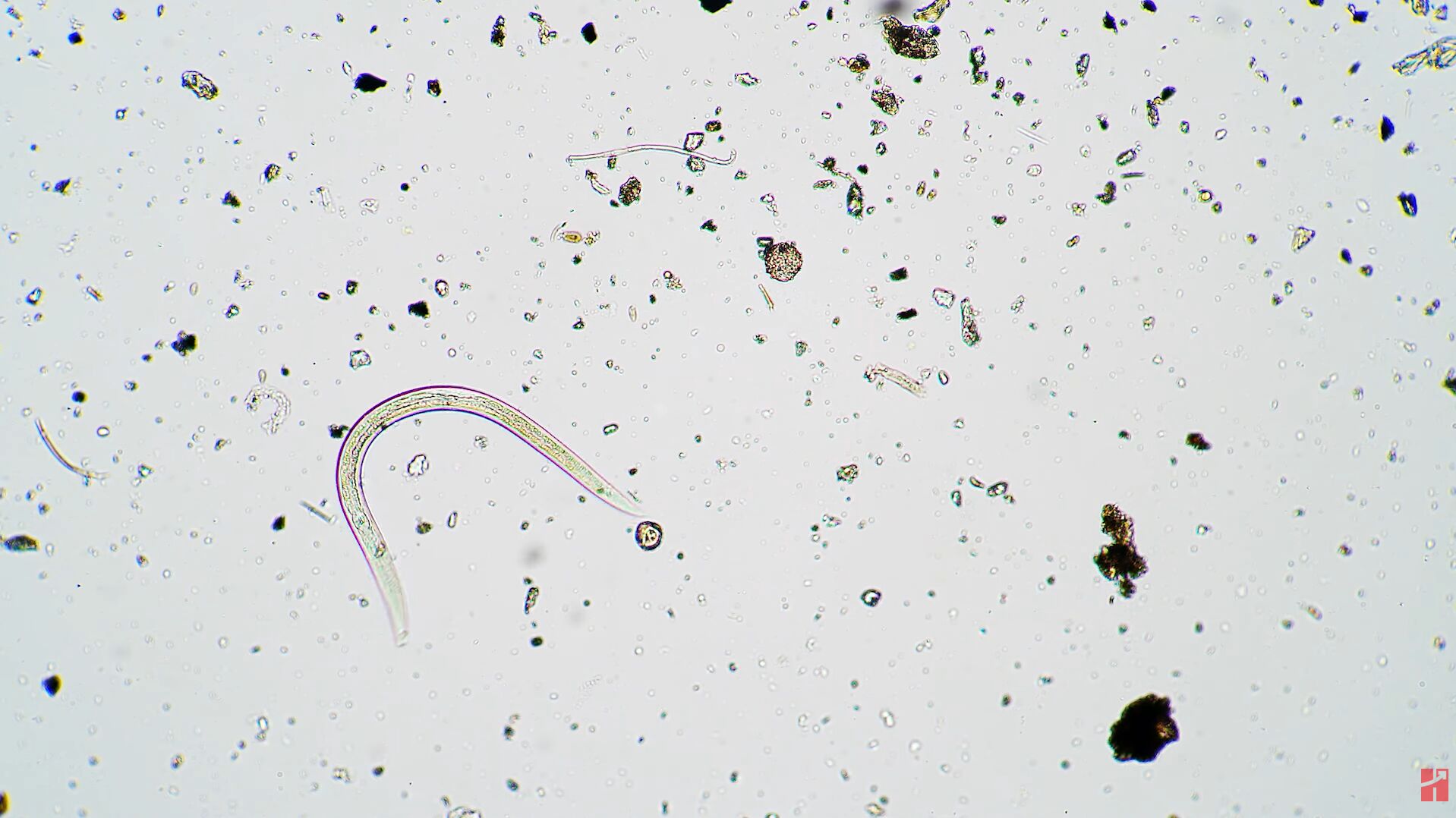 Imagem microscópica de vida aquática e detritos