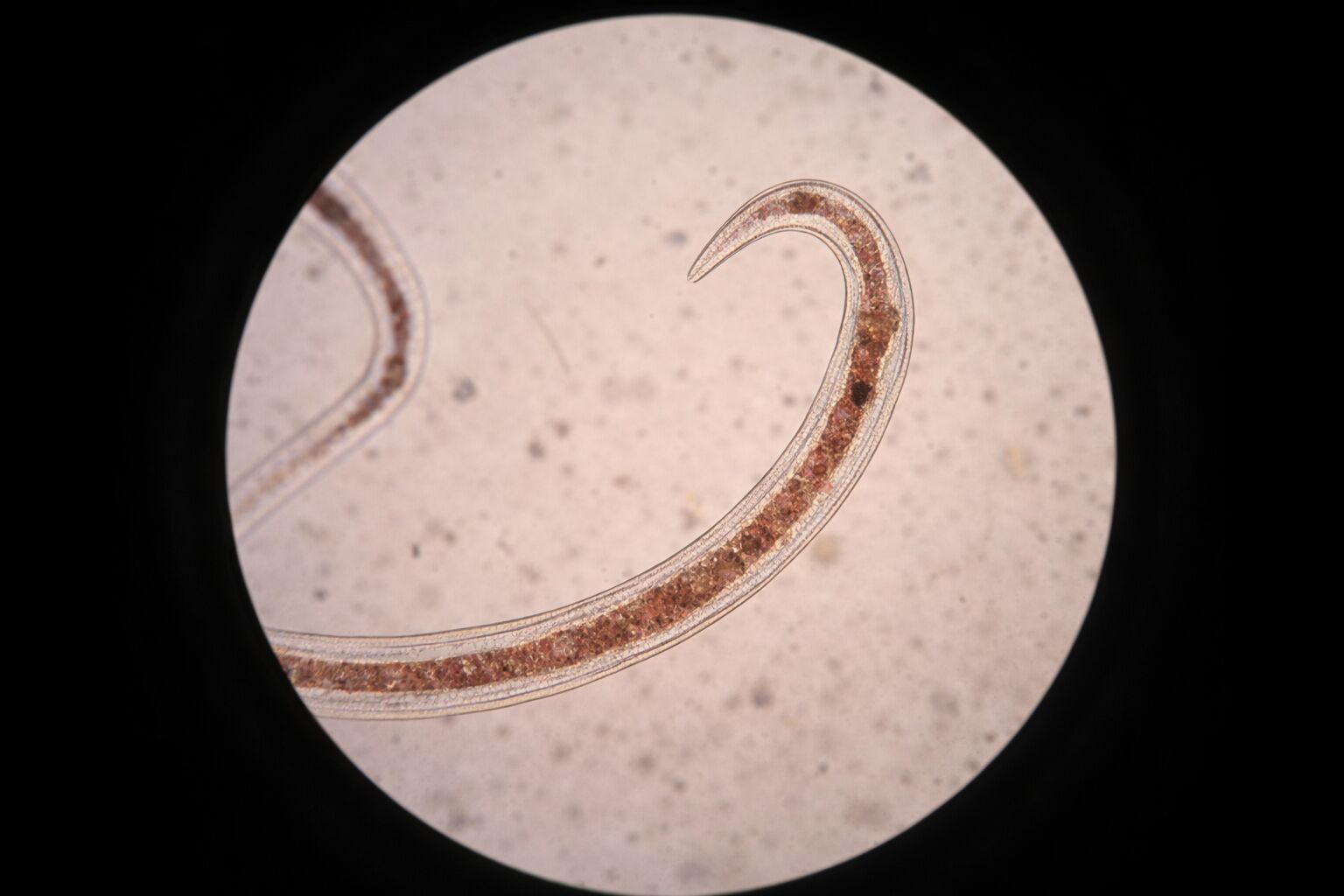 Nariz de um nematoide sob microscópio