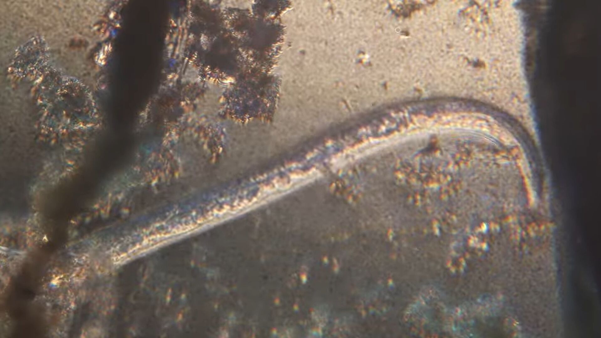 Verme microscópico em ambiente aquático