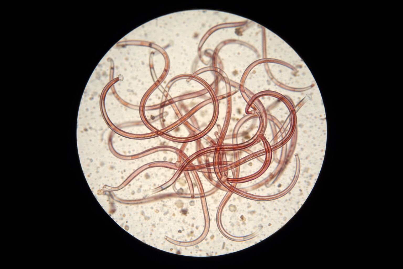 Vermes microscópicos vistos ao microscópio