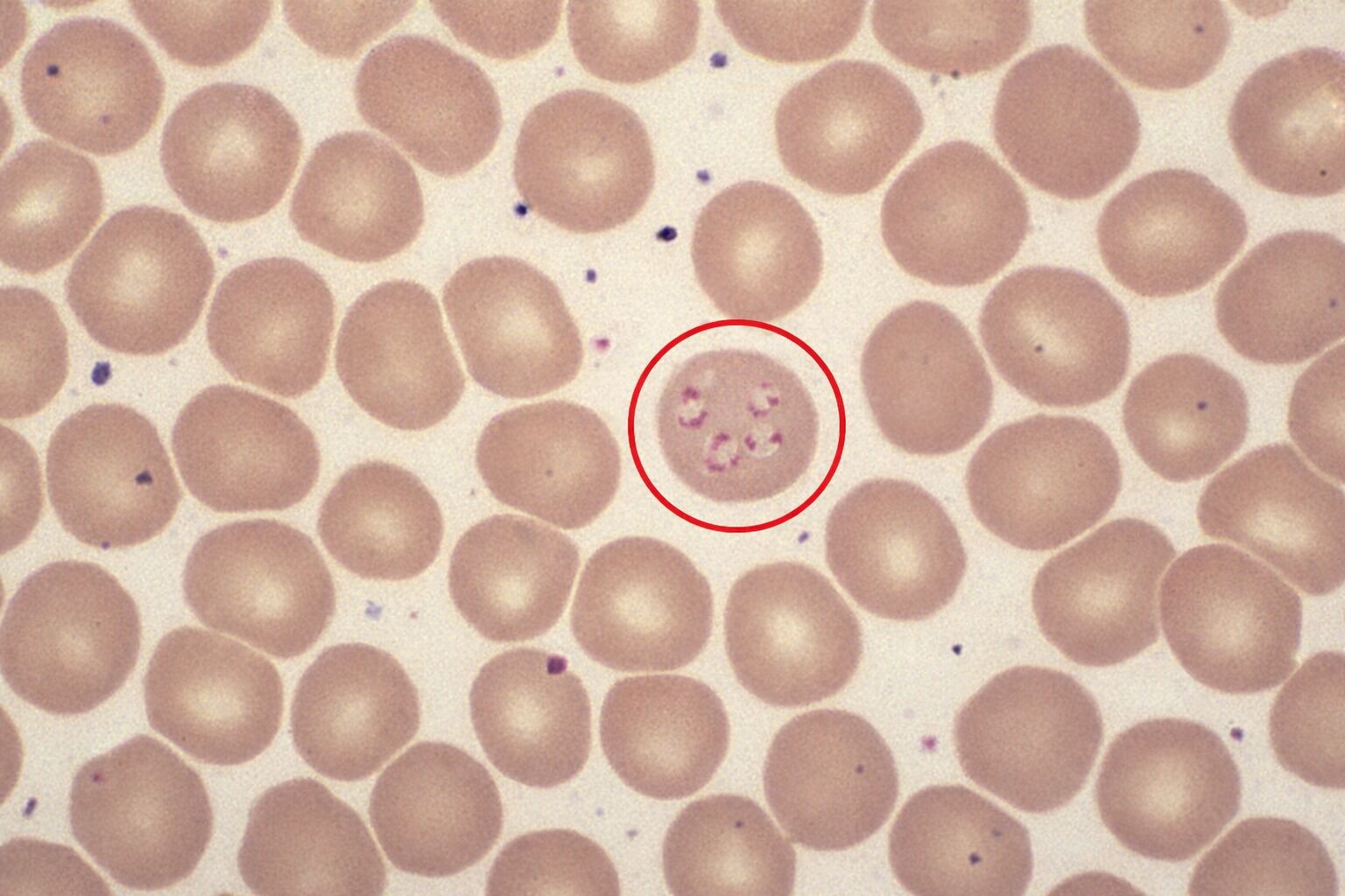 Imagem microscópica de células sanguíneas com destaque