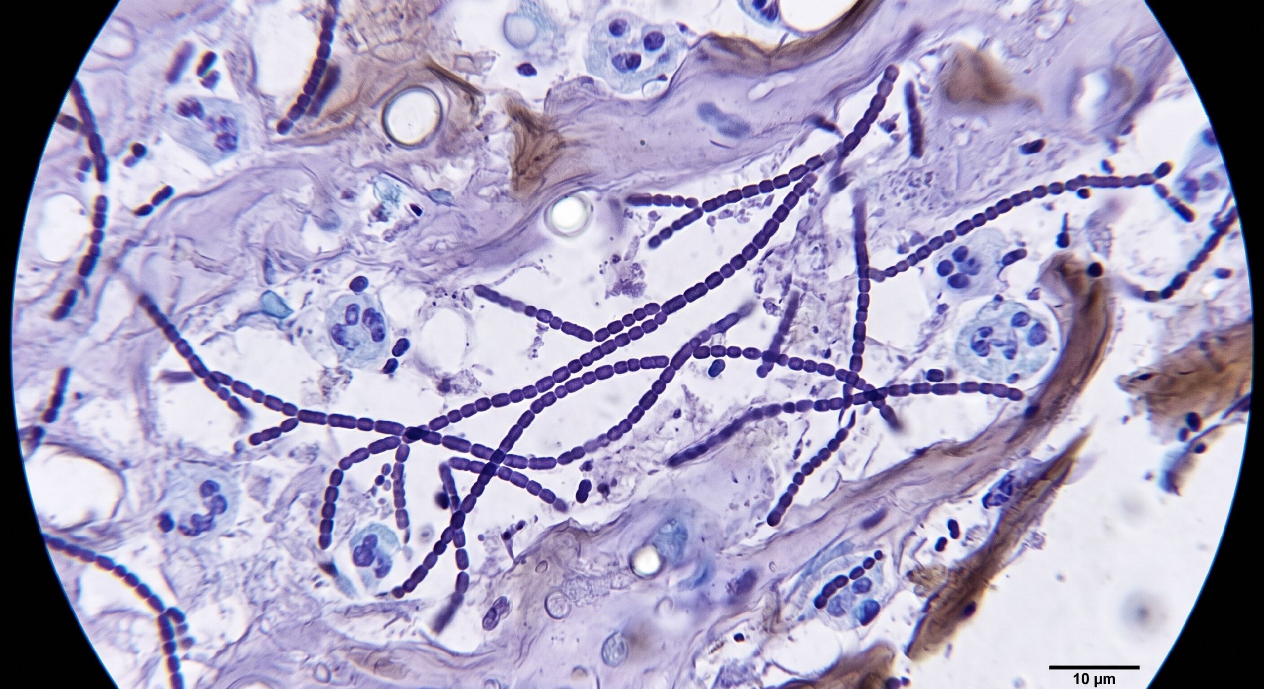 Microscopia mostrando células e estruturas bacterianas